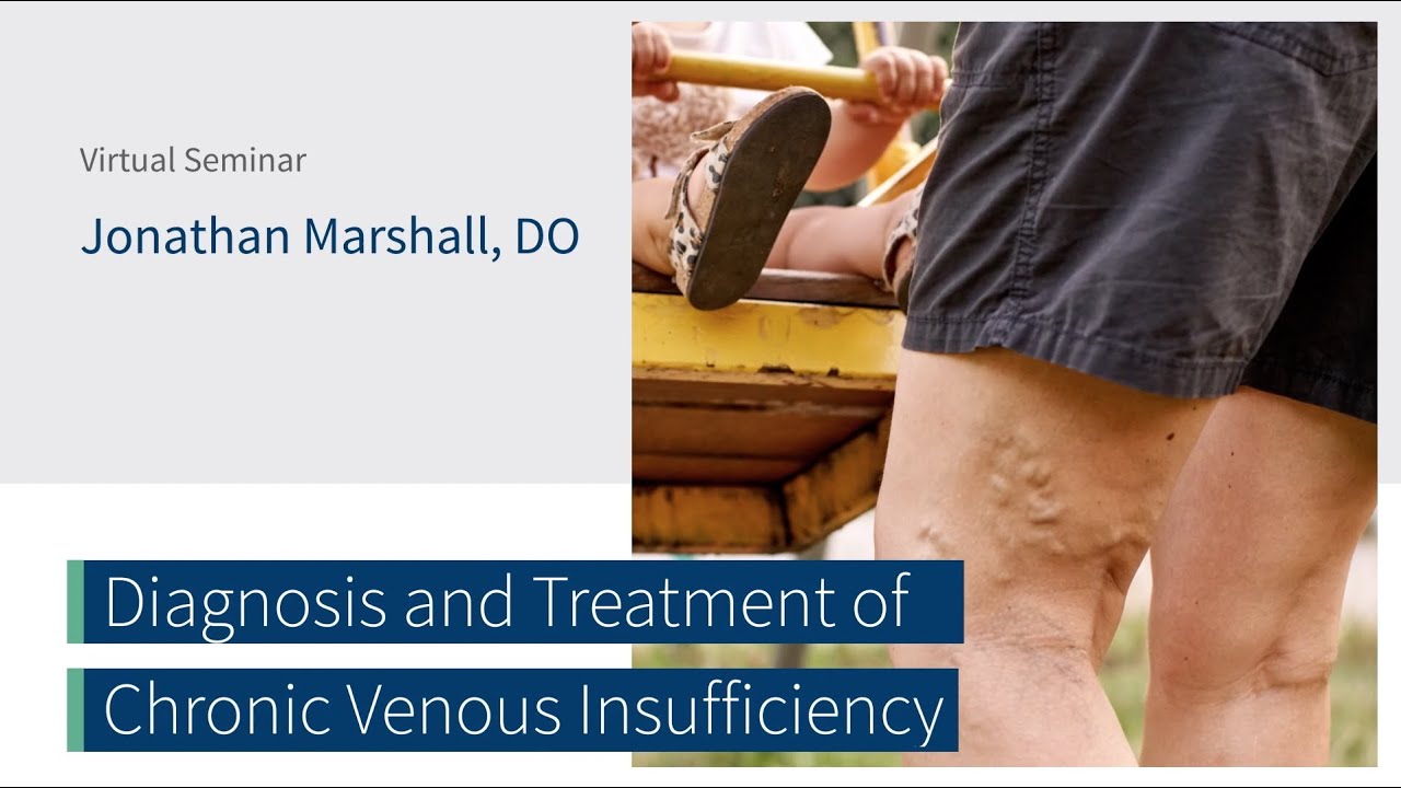 Diagnosis & Treatment of Chronic Venous Insufficiency w/ Dr. Jonathan Marshall | The CORE Institute