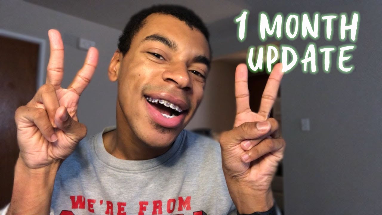 1 MONTH BRACES UPDATE (some concerns + life with a palatal expander)