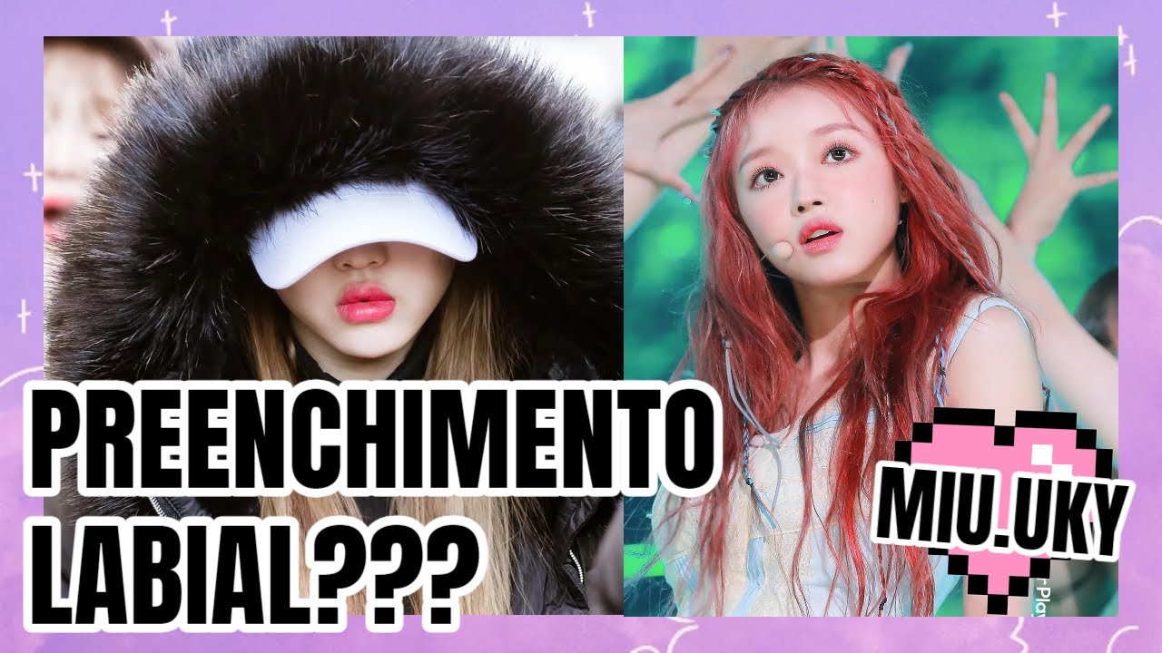 🟣 AS CIRURGIAS PLÁSTICAS MAIS CRITICADAS NO KPOP