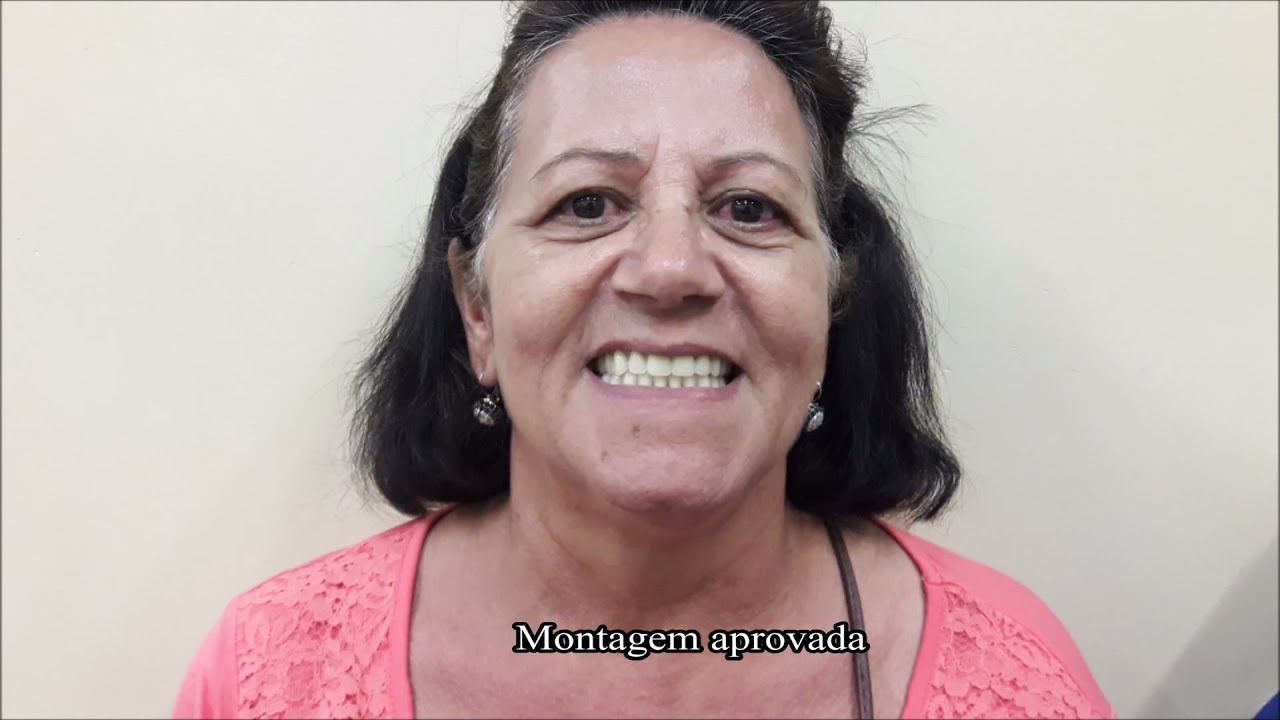 Planejando um Sorriso com Prótese Total