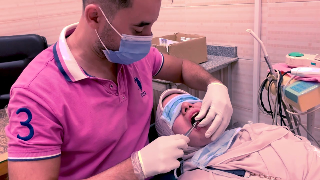 خلع جراحى فى دقيقة وتعليمات الخلع