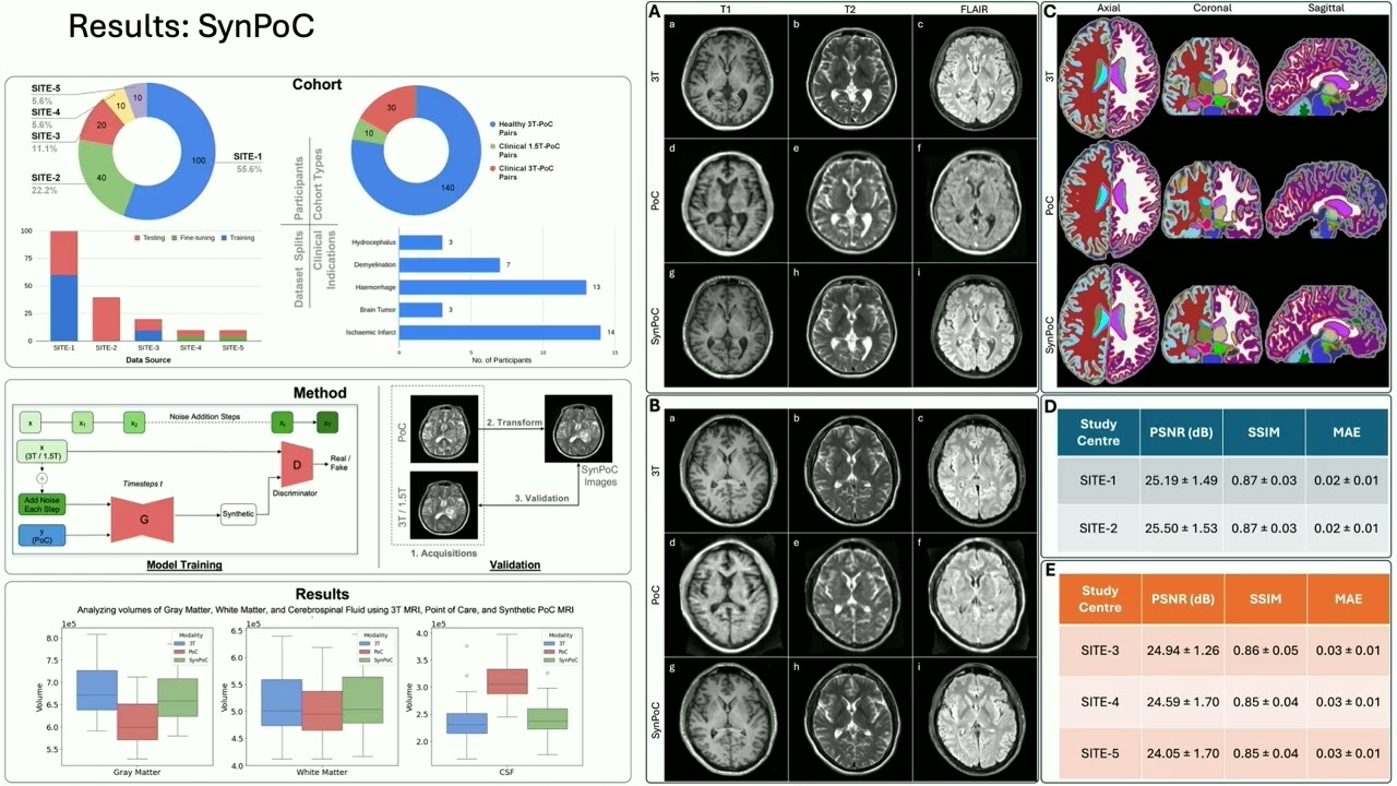 OHBM 2025 | Educational Course | When they go high we go low: Ultra-low field MRI scanning | Part 7