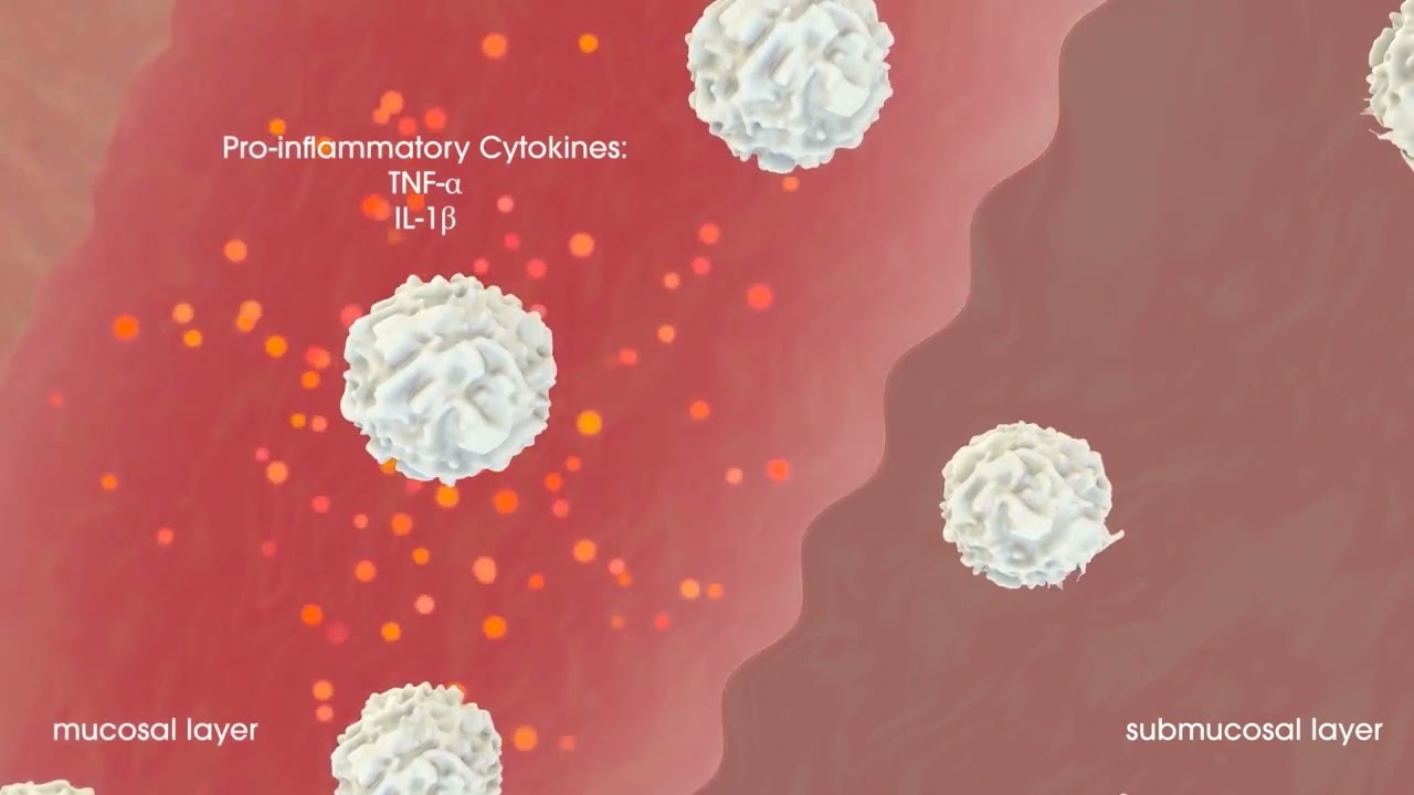 Difflam  Benzydamine MOA video 1