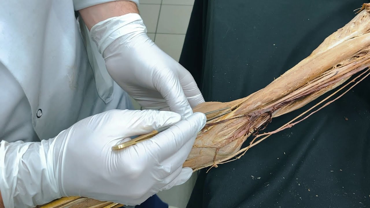 Obere Extremit&auml;t - topografische Anatomie des Menschen | Sezierkurs Live Anatomie Innsbruck