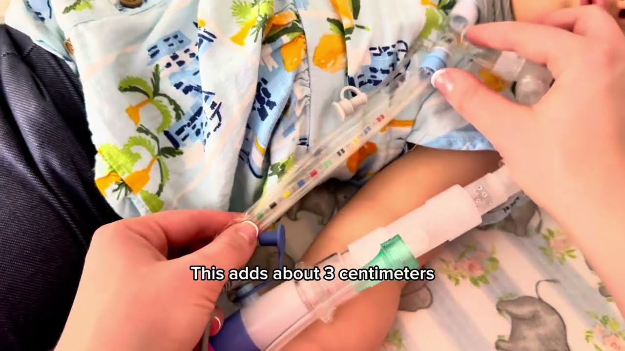 Trach Suctioning at Home | Real-Life Guide for Medically Complex Child