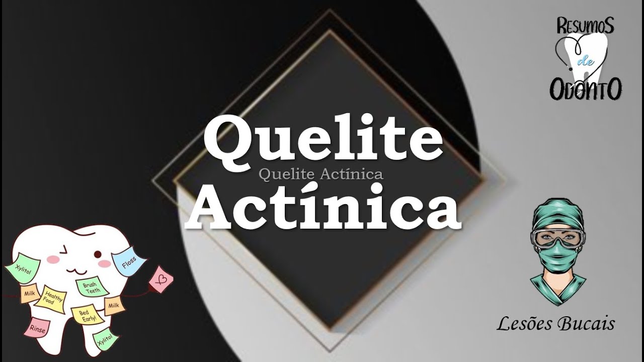 Quelite Actínica | Resumos de Odonto