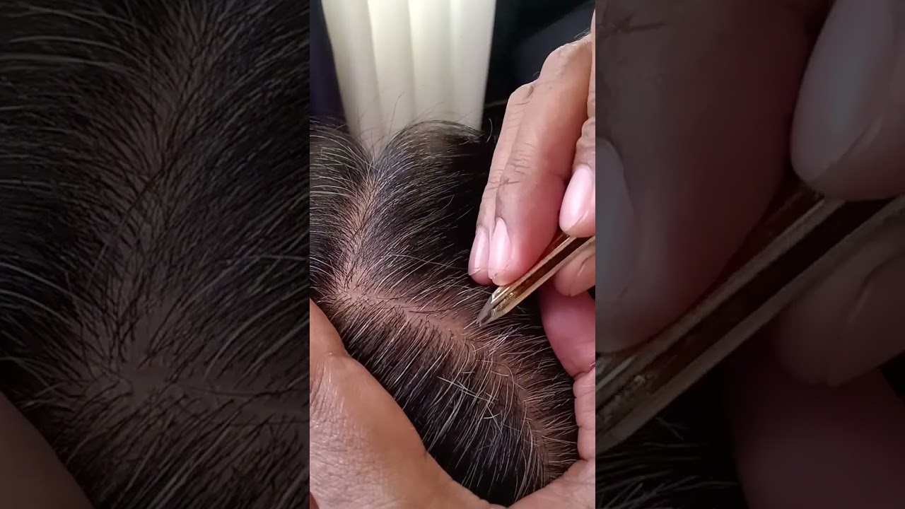 most satisfying White hair removal 0.60#stressremoval #satisfying