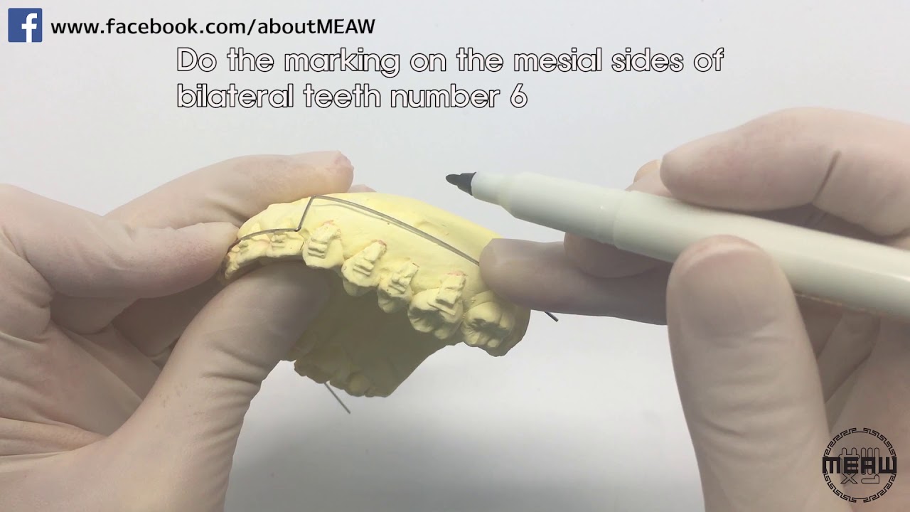 .016x.022ss Utility arch wire (Eng sub)