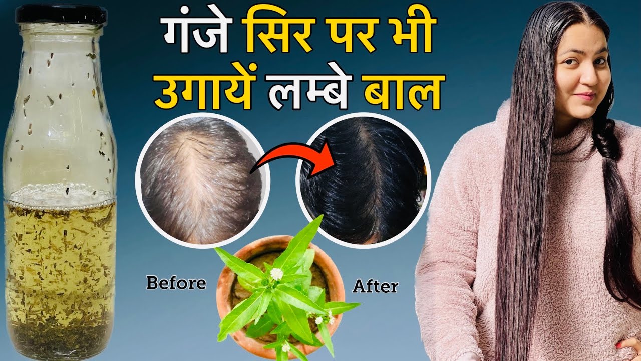 30 Days *Bhringraj* Hair Growth Challenge : Stop Hair Fall & Regrow Hair Faster, Longer & Thicker❤️