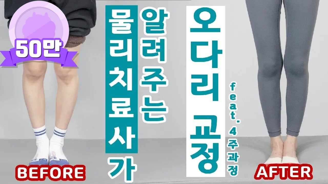 현직 물리치료사가 알려주는 오다리 교정법(feat.실제교정과정) | 정파카