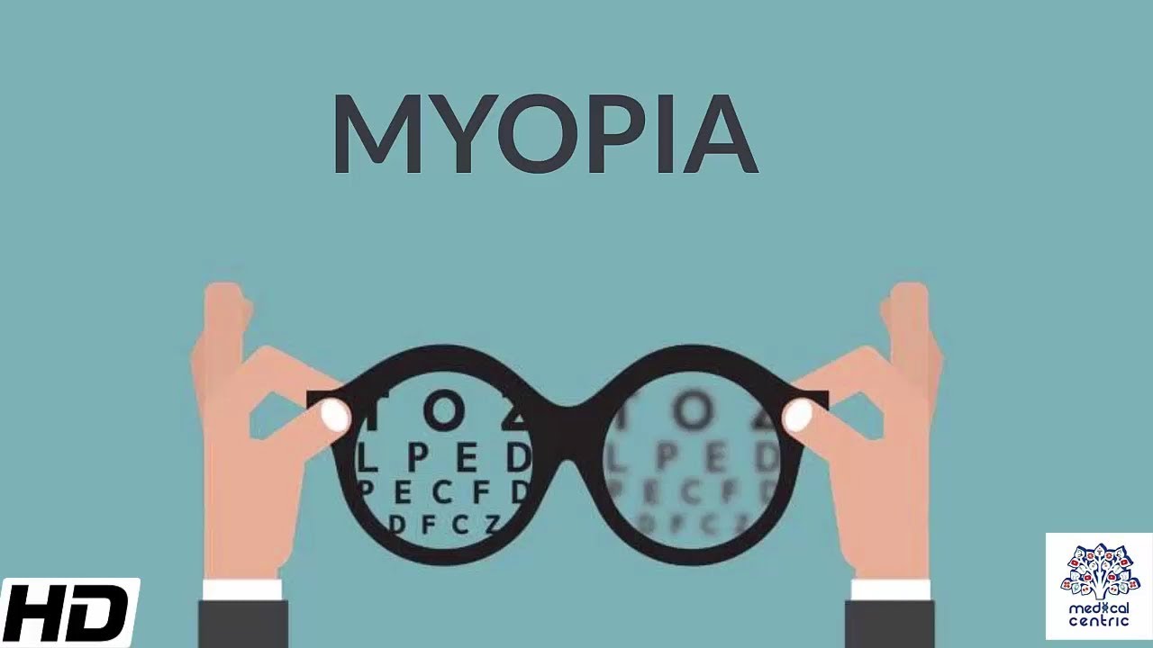 Myopia, Signs and Symptoms, Causes, Diagnosis and Treatment.