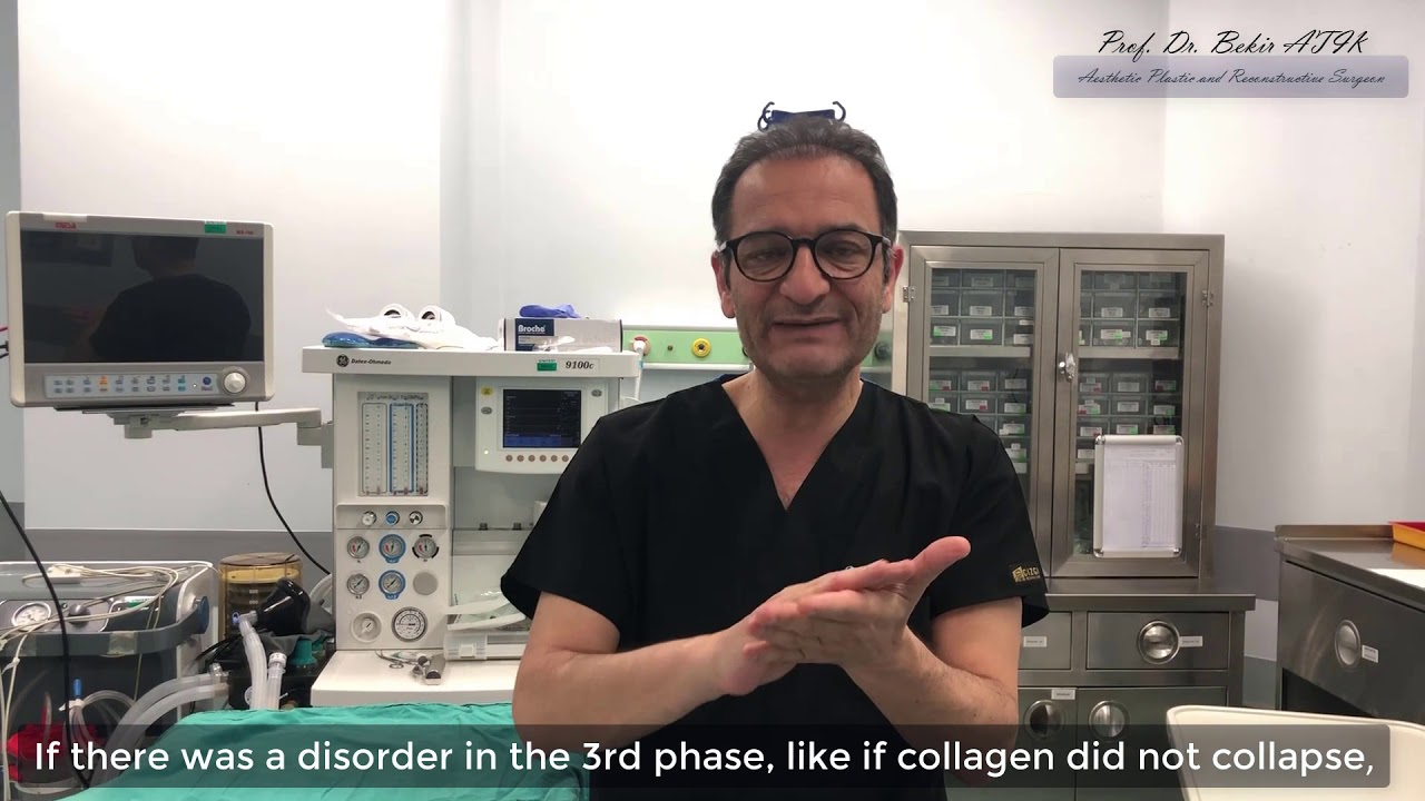 Keloid Tedavisi - Prof. Dr. Bekir ATİK