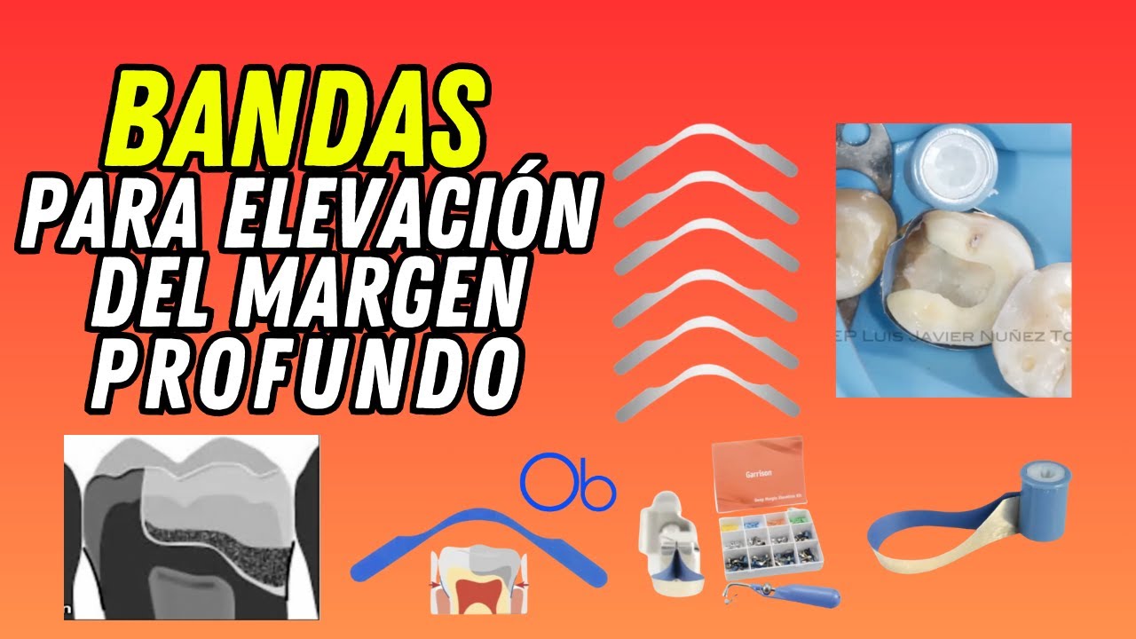 Bandas para elevación de margen 🦷
