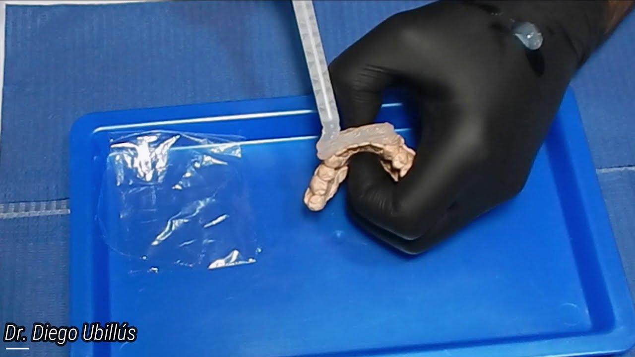 ¿Cómo usar silicona transparente? Parte 1 😁 - Elite Glass - para técnica de estampado con resinas 🦷