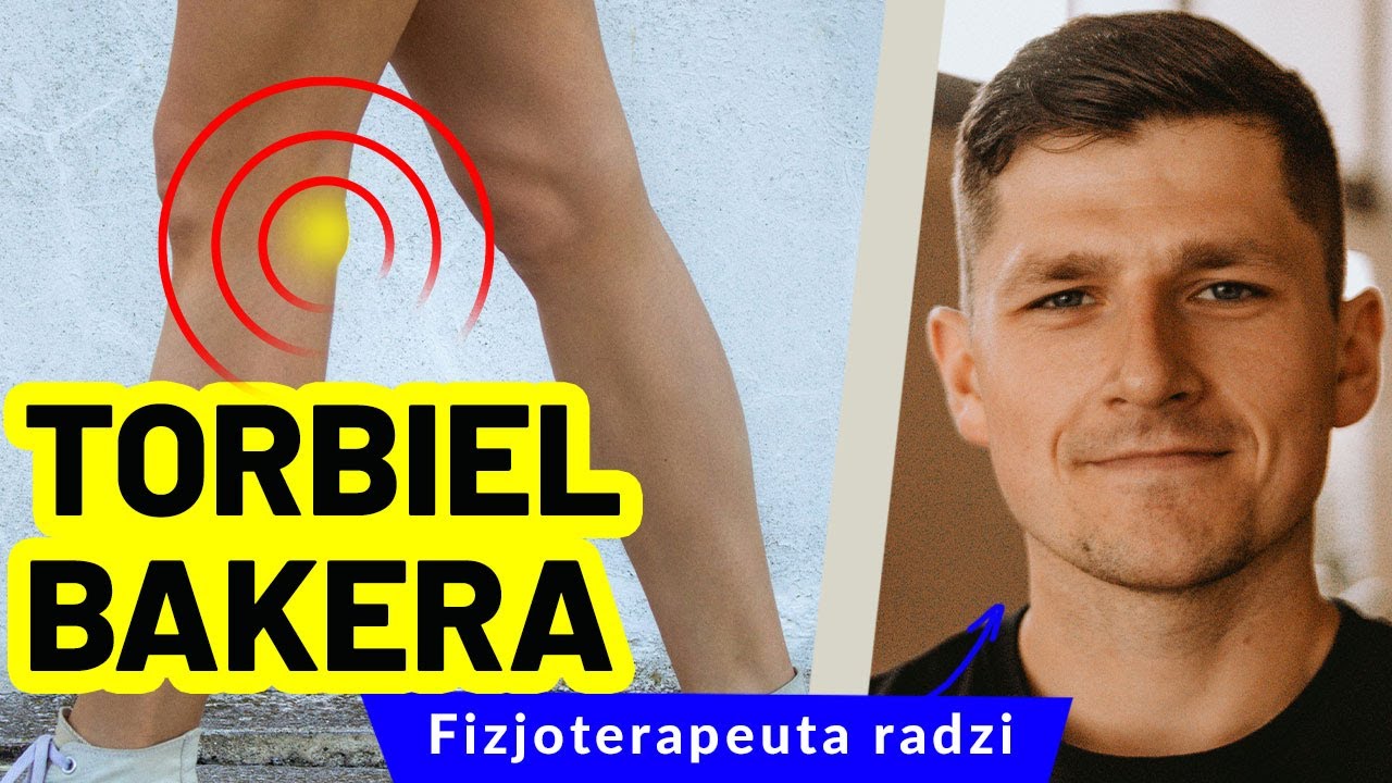 Jak leczyć torbiel Bakera? O przyczynach, objawach i rehabilitacji torbieli dołu podkolanowego.