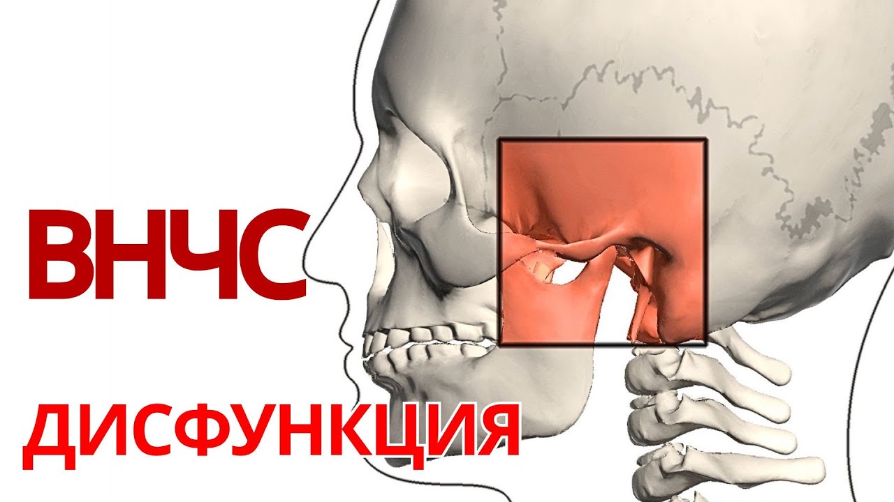 ДИСФУНКЦИЯ ВНЧС | 6 причин хруста и боли в ВНЧС. Диагностика. Лечение.
