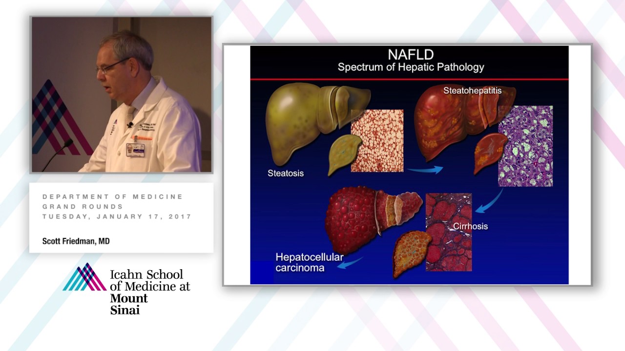 The Dawn of Translation in NASH and Hepatic Fibrosis