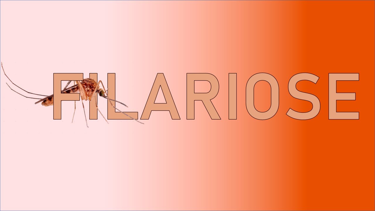 Filariose: Conhecendo uma Doen&ccedil;a Negligenciada