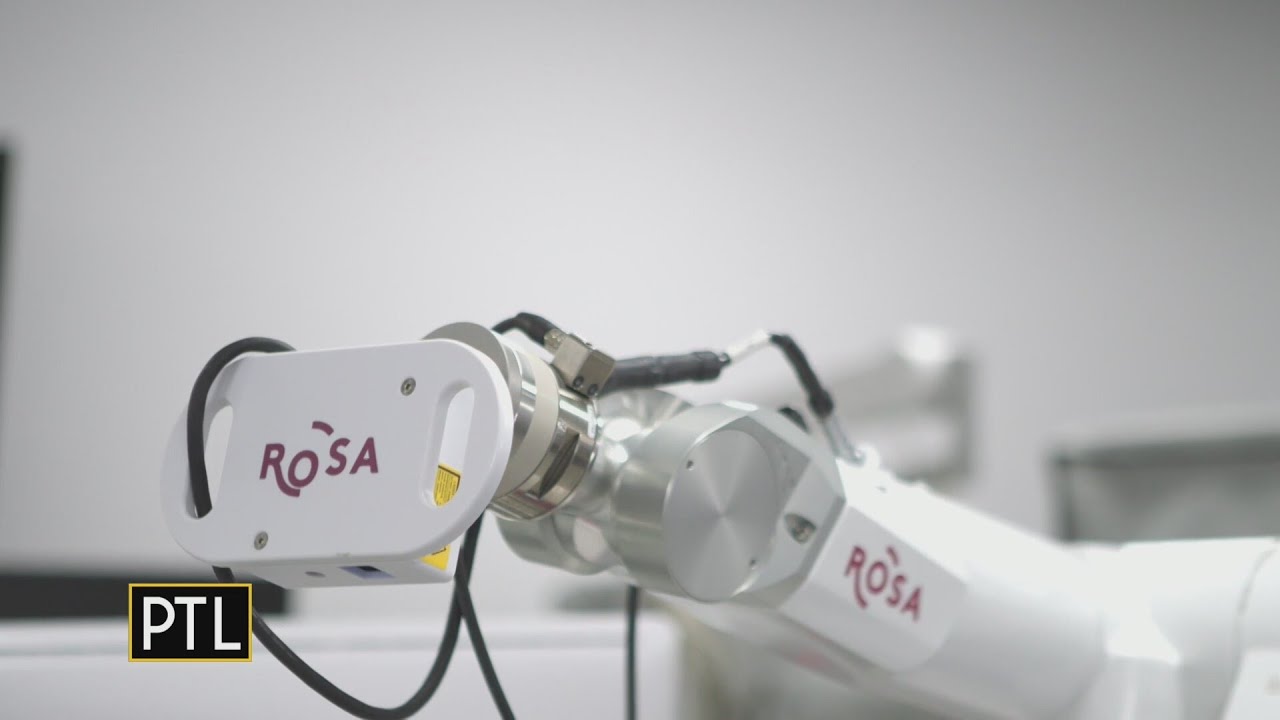 Eye On Health: ROSA robot helping patients with epilepsy