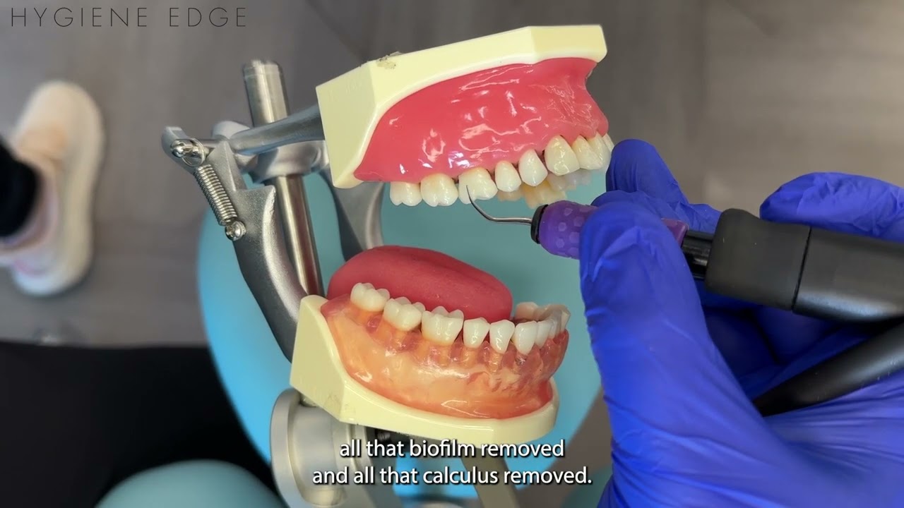 How to Channel with an Ultrasonic Tip Featuring Nordent LuxPoint