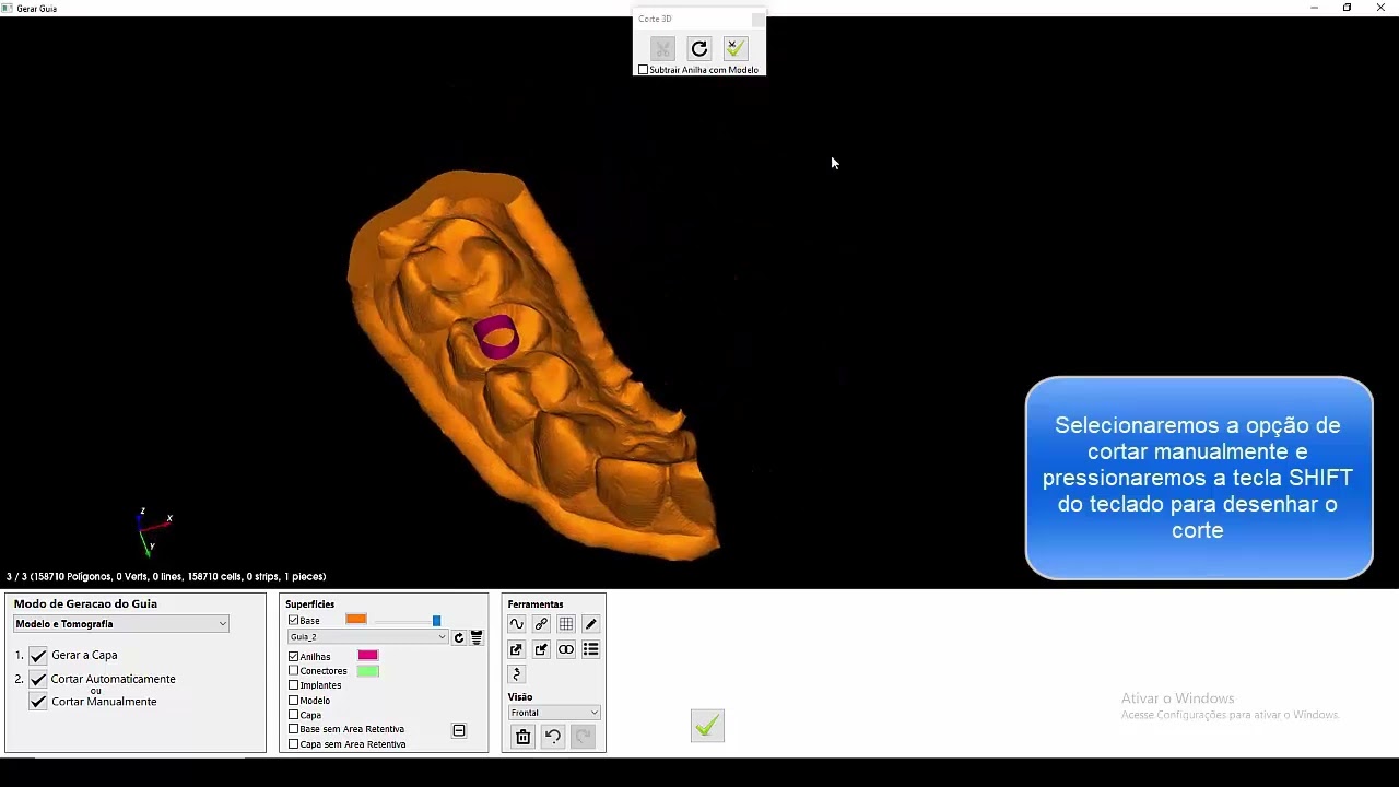 Guia Sobre Elemento Dental que Será Extraído (173)