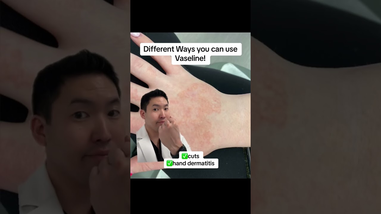 Different Ways to Use Vaseline from a Dermatologist!