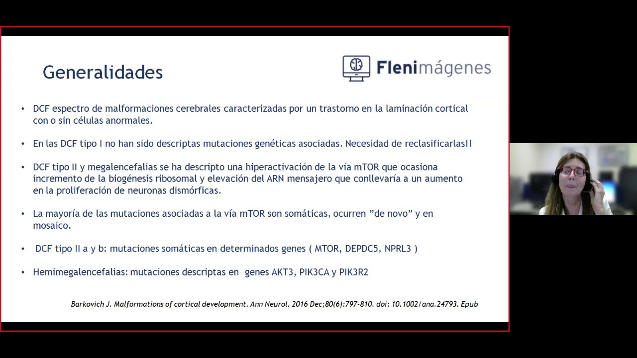 Webinar Imágenes en Epilepsia: Displasias Corticales Focales