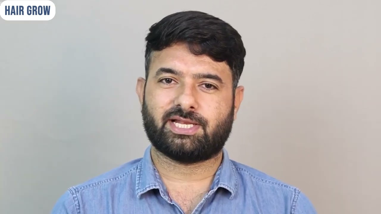 Patient Honest Review After Hair Transplant Before After Results #hairtransformation #haircare 
