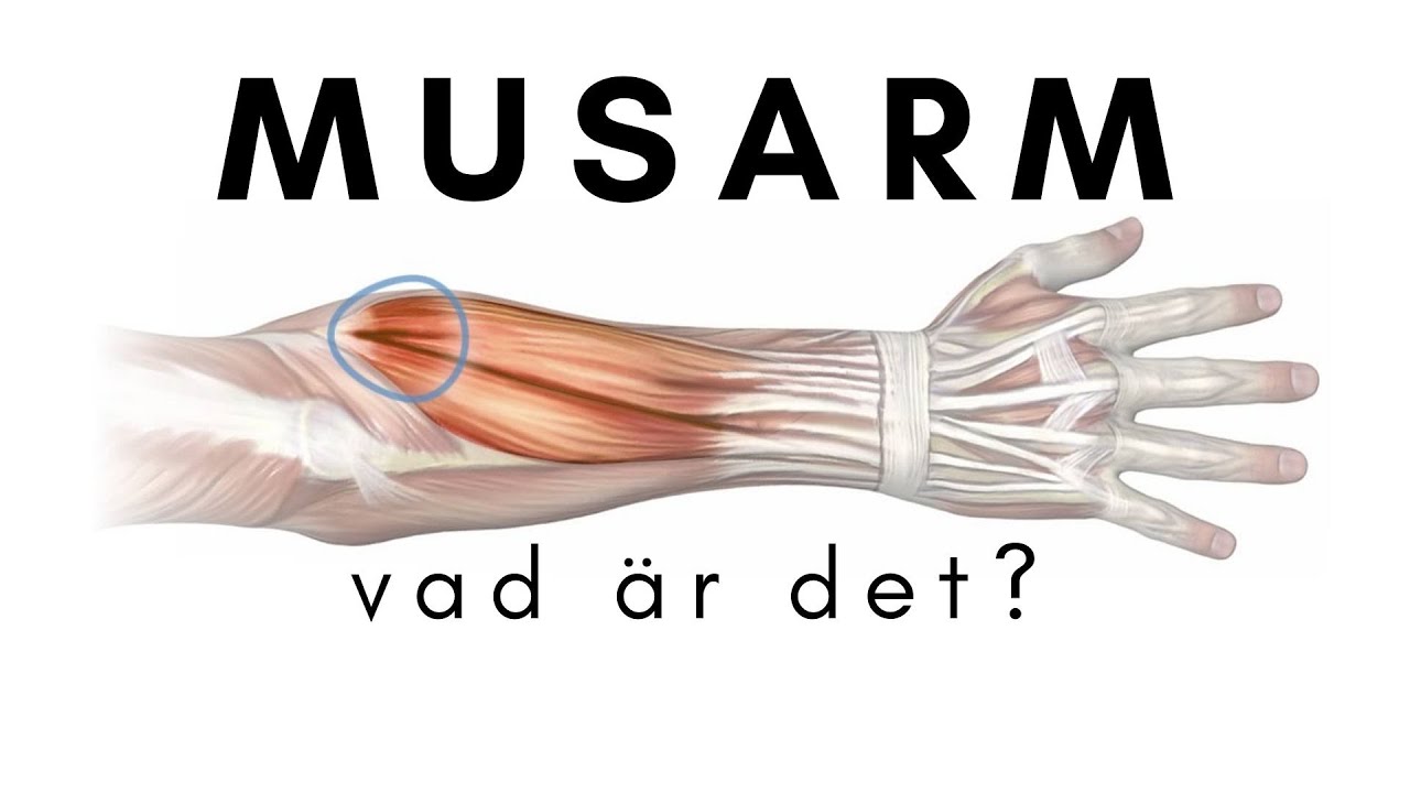 Vad &auml;r en musarm