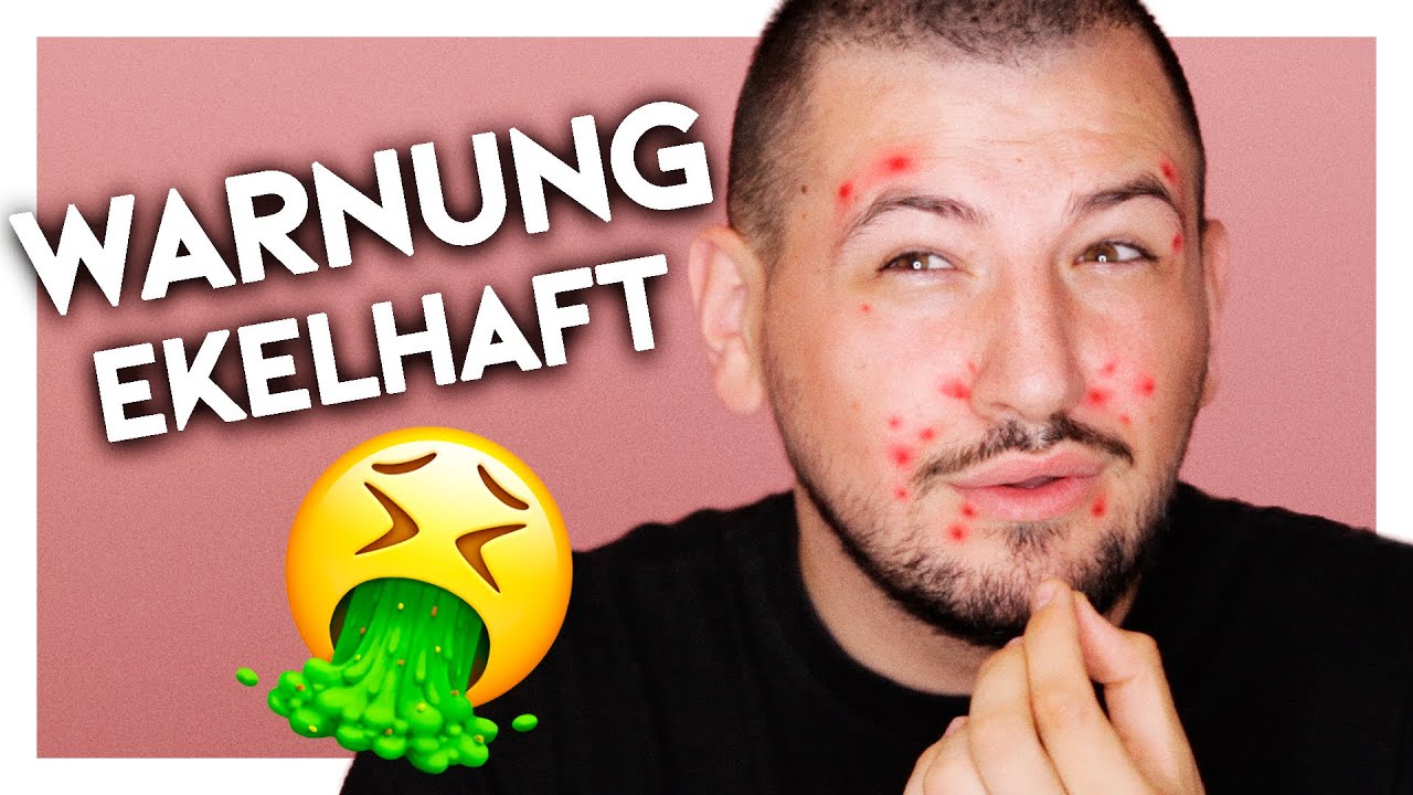 Er macht ein PICKEL MAKE-UP TUTORIAL | Lipstickbakery