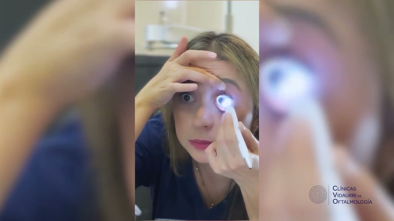 👉 Como Colocar y Retirar Lentes Esclerales Rígidos.