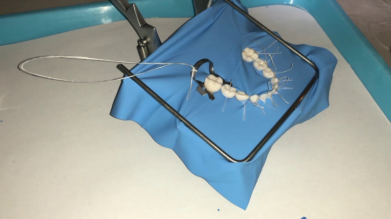 Video de colocaci&oacute;n de dique de hule en tipodonto infantil