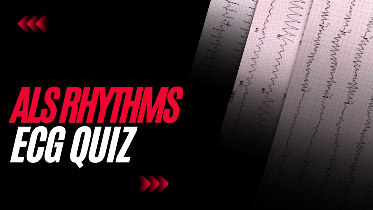 ALS Rhythms: ECG Quiz