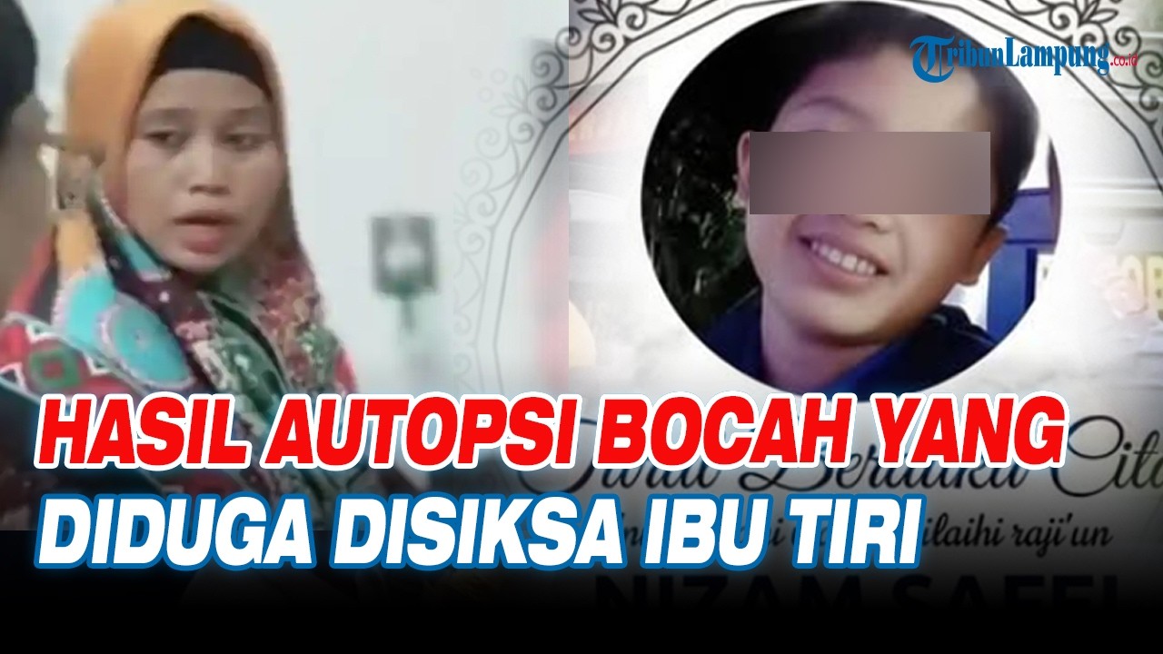 Hasil Autopsi Bocah yang Diduga Dipaksa Ibu Tiri Minum Air Panas, Paru-paru Bengkak