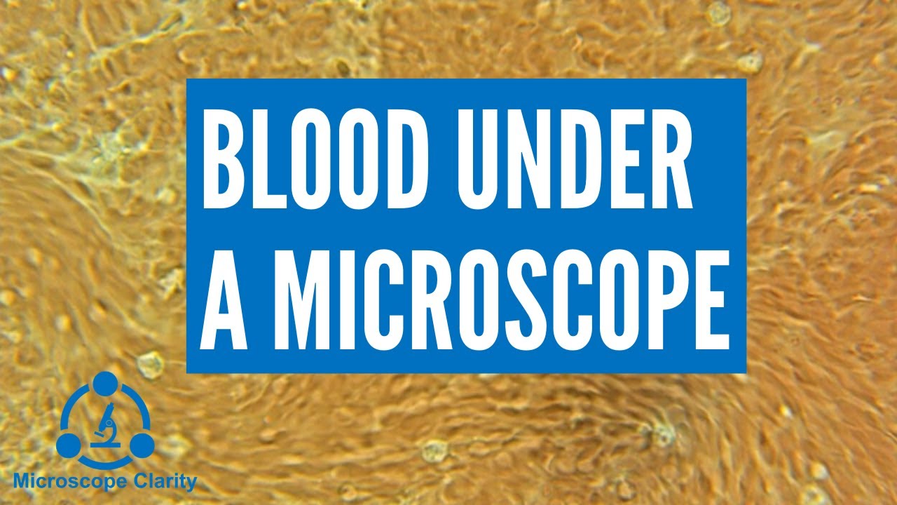 Blood Under a Microscope