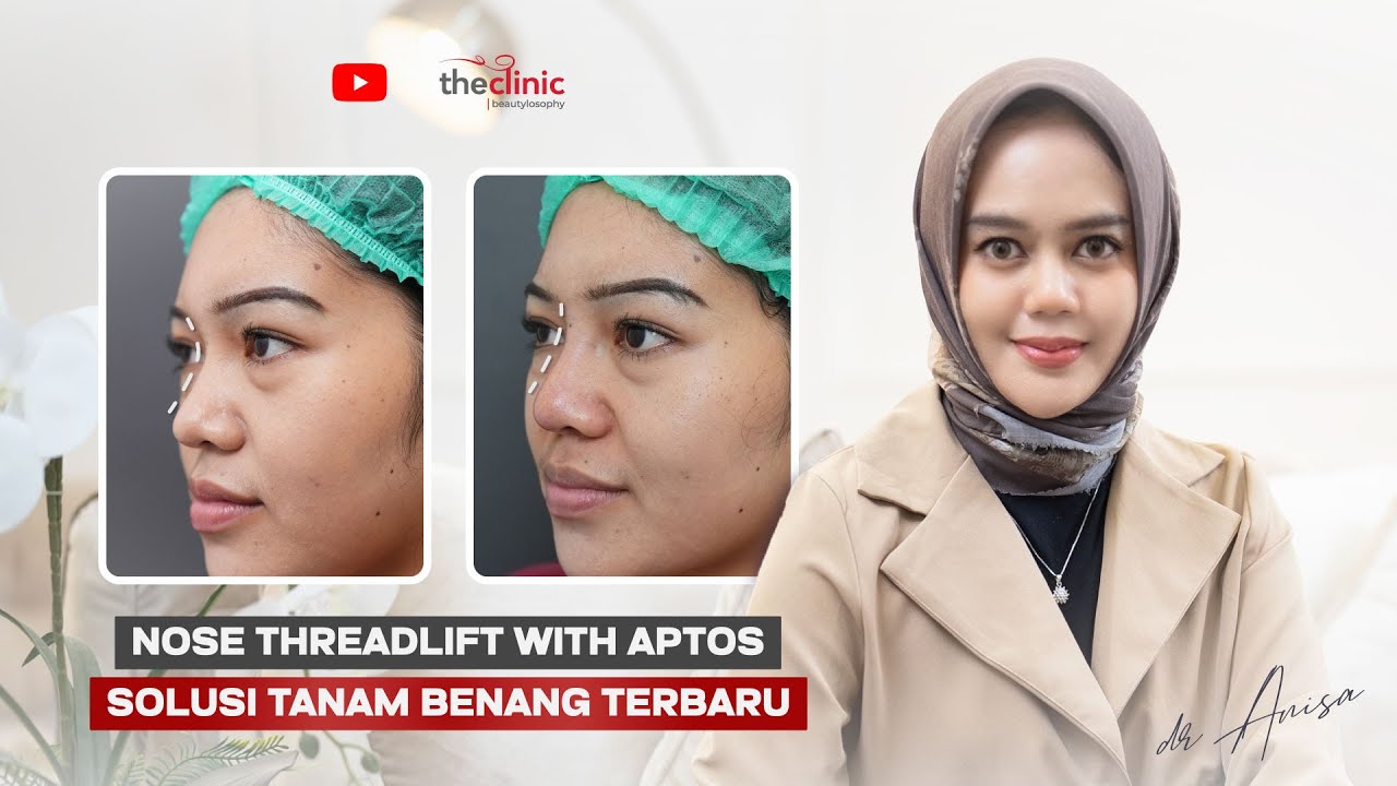 LEBIH PERCAYA DIRI DENGAN TANAM BENANG | APTOS