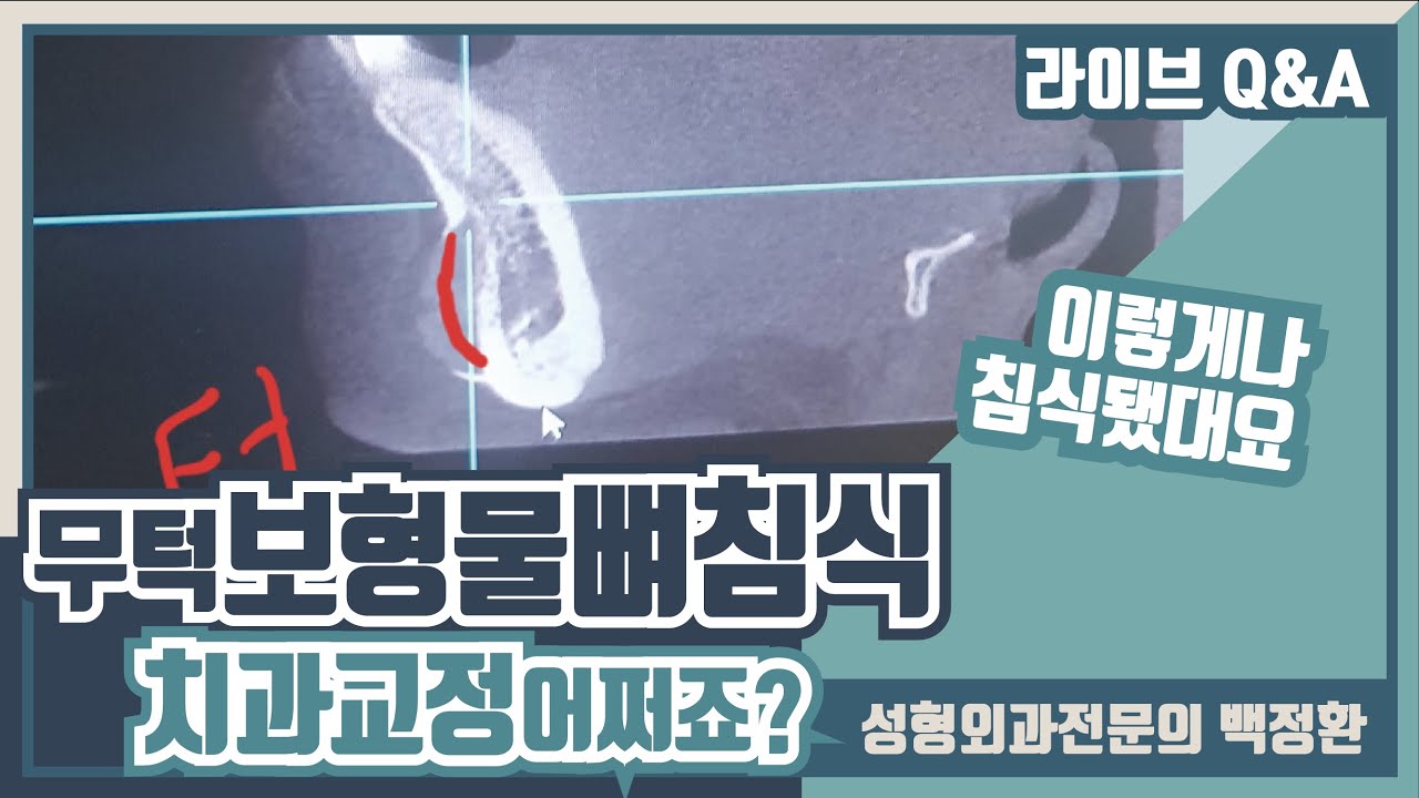 뼈침식인가요? 치아교정을 해야 하는데 걱정입니다...