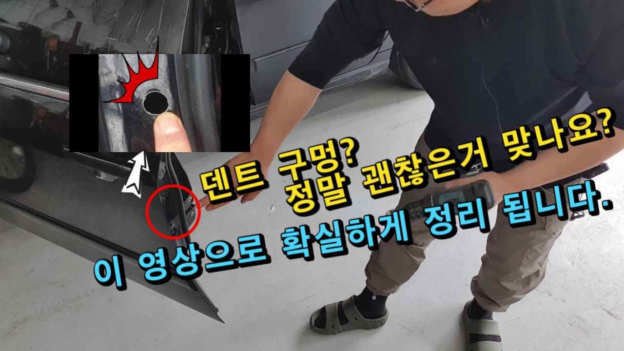 덴트 할 때 만들어야 한다는 구멍? 싫은데 정말 어쩔 수 없는건가요?