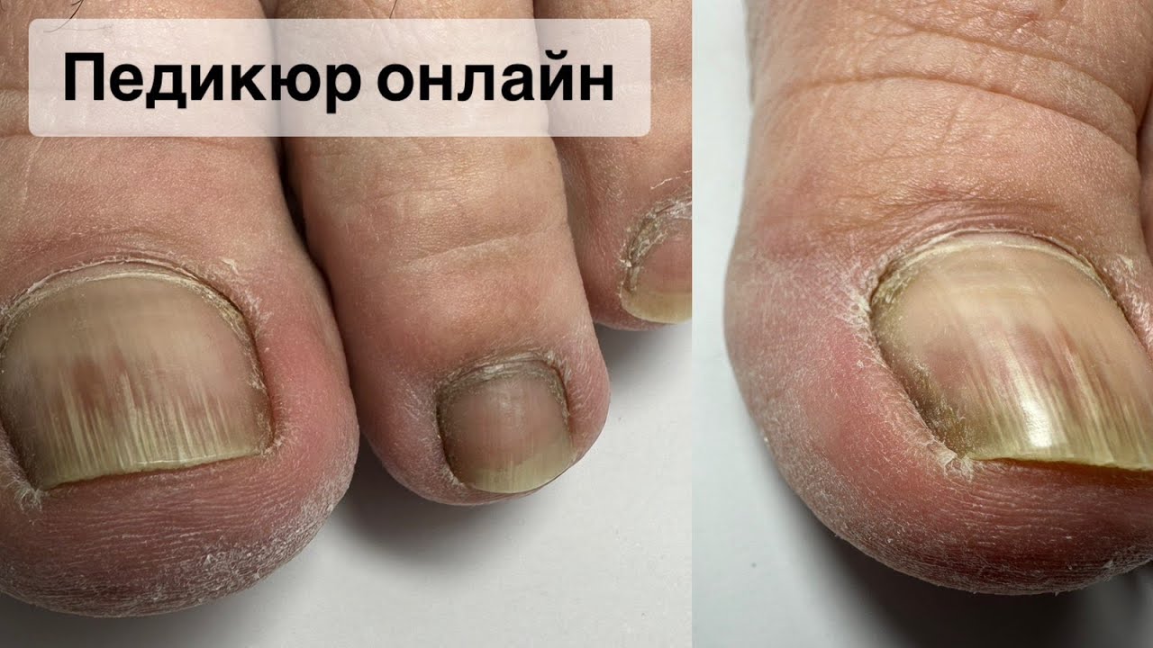 ПЕДИКЮР ОНЛАЙН. Виктория Авдеева