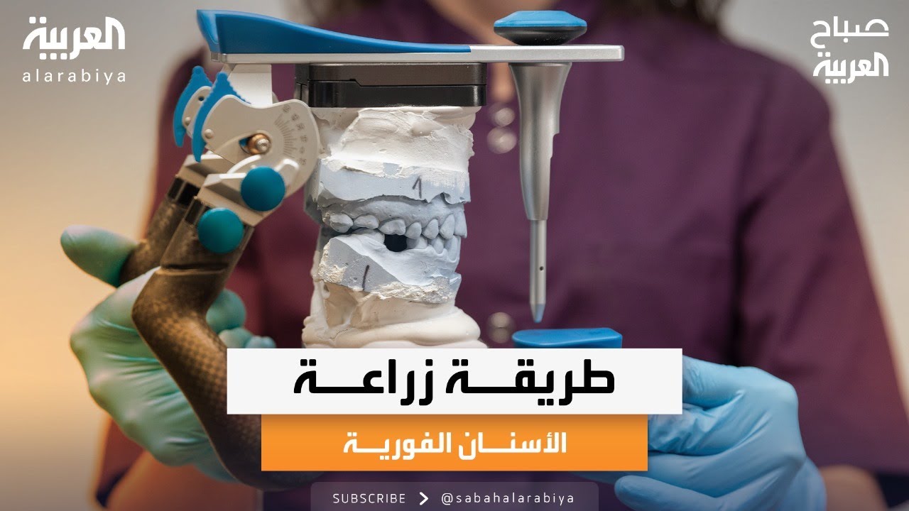 صباح العربية | طبيب الأسنان مجد ناجي يوضح طريقة زراعة الأسنان الفورية