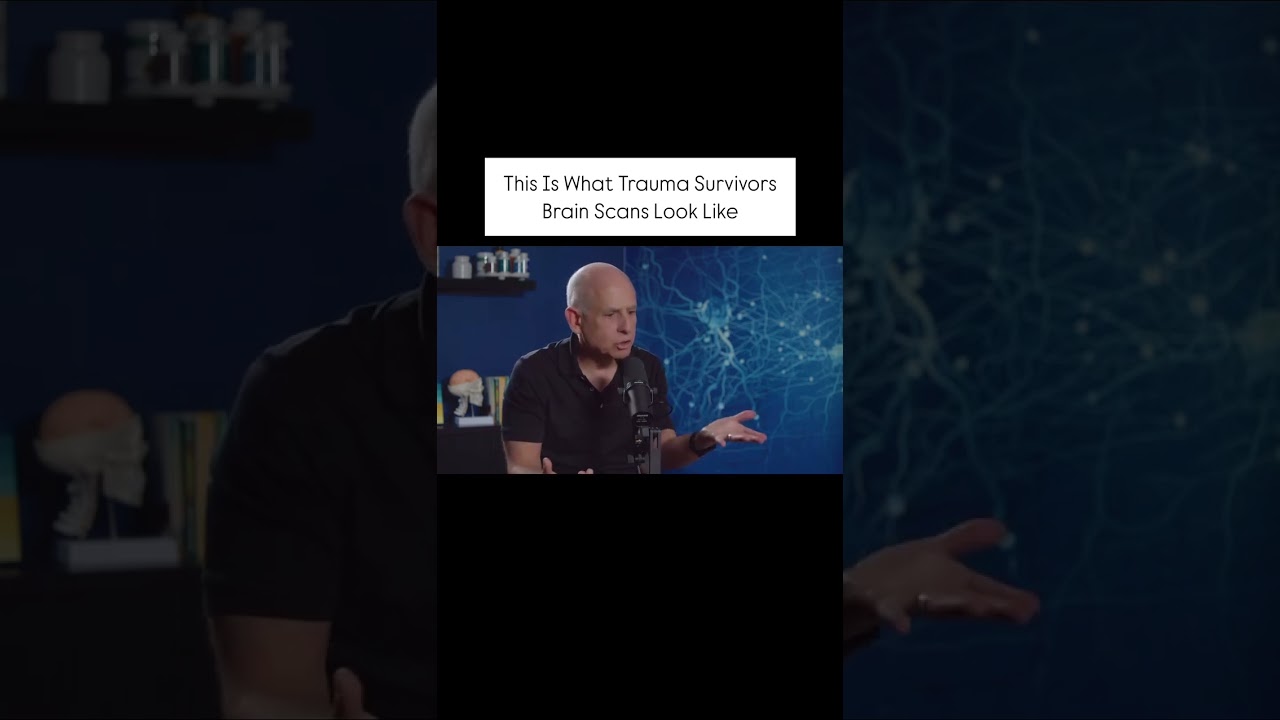 This Is What Trauma Survivors Brain Scans Look Like