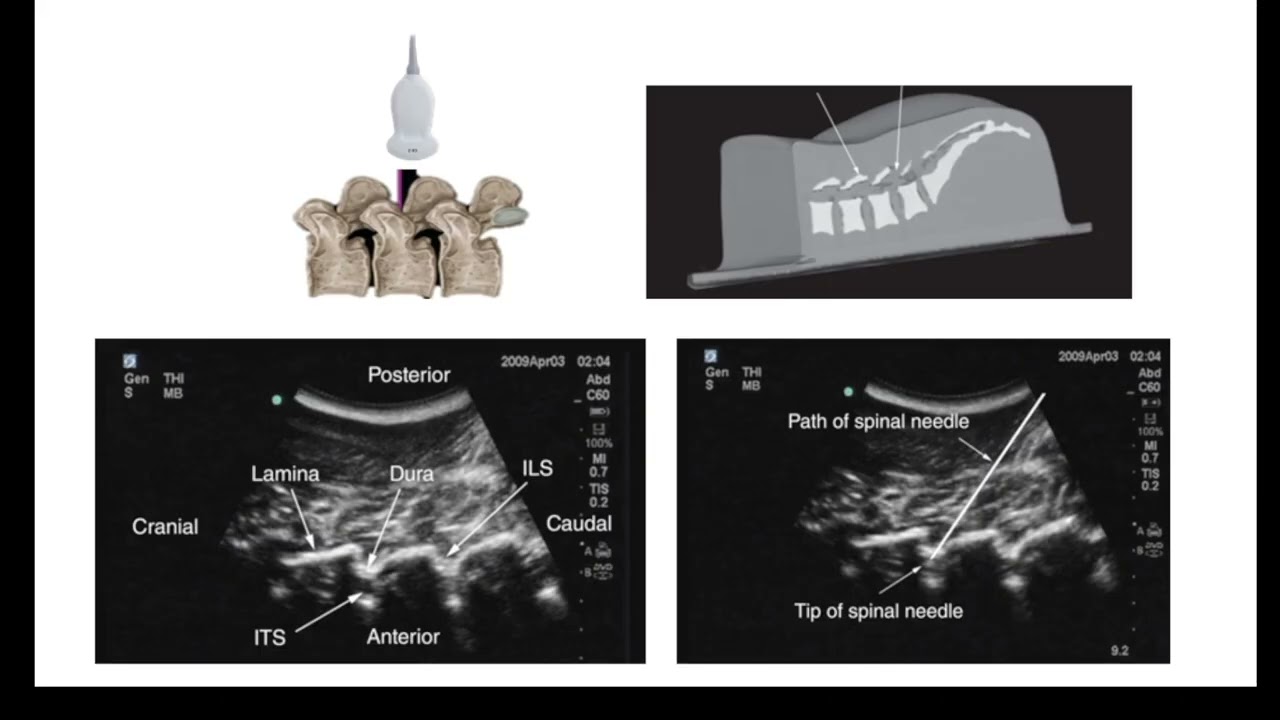 AULA 3 - AVALIAÇÃO ULTRASSONOGRÁFICA DA COLUNA VERTEBRAL. CONCEITO DE AVALIAÇÃO 