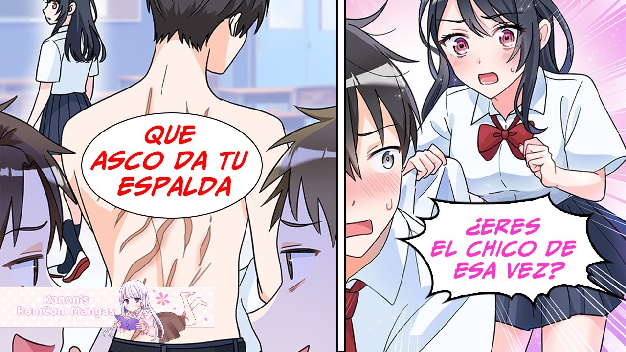 Cicatrices para toda la vida, pero que valieron la pena. [Doblaje Latino]