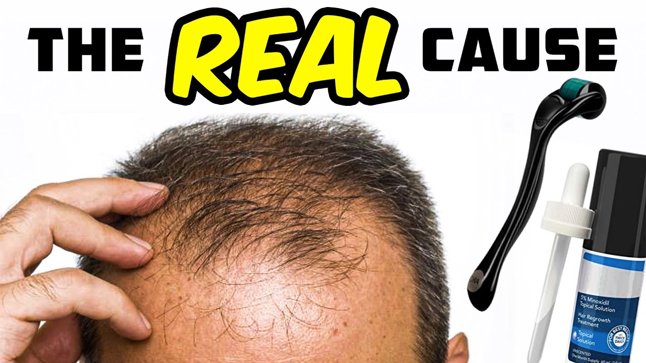 The REAL Cause Of Hair Loss And How To Prevent It
