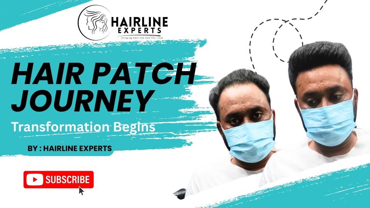 Front Lace Hair Patch Styling | Celebrity Hair Patch Look | Hairline Experts Ludhiana Punjab