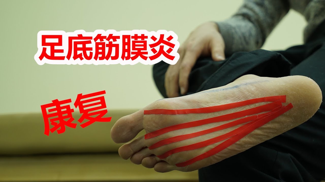 医学实例详解，足底筋膜炎：脚后跟疼，简单3步，和疼痛说再见