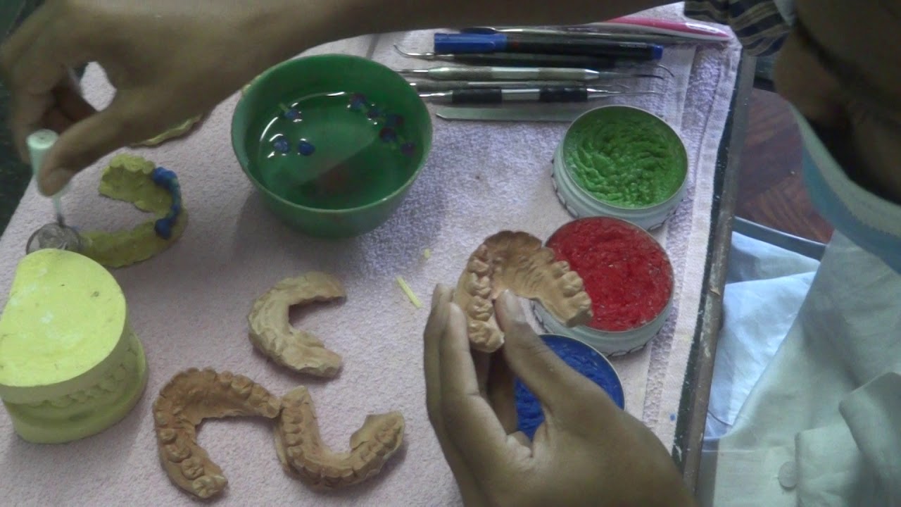 Application of sprue wax(Sheetal Enterpriss) on prepared wax pattern