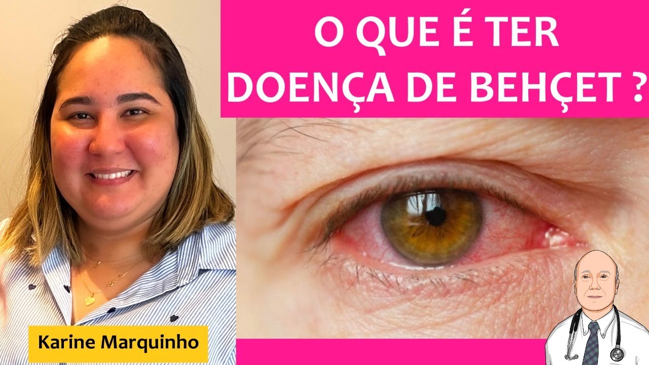 Como é ter doença de Behçet? A experiência pessoal de quem úlceras orais, dores e perda de visão