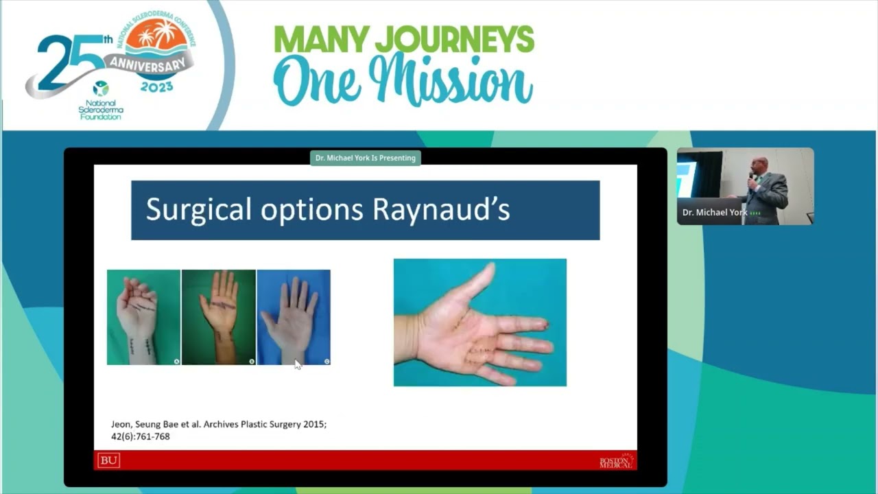 Raynaud's, Ulcerations and Calcinosis in Systemic Sclerosis, Michael York, MD