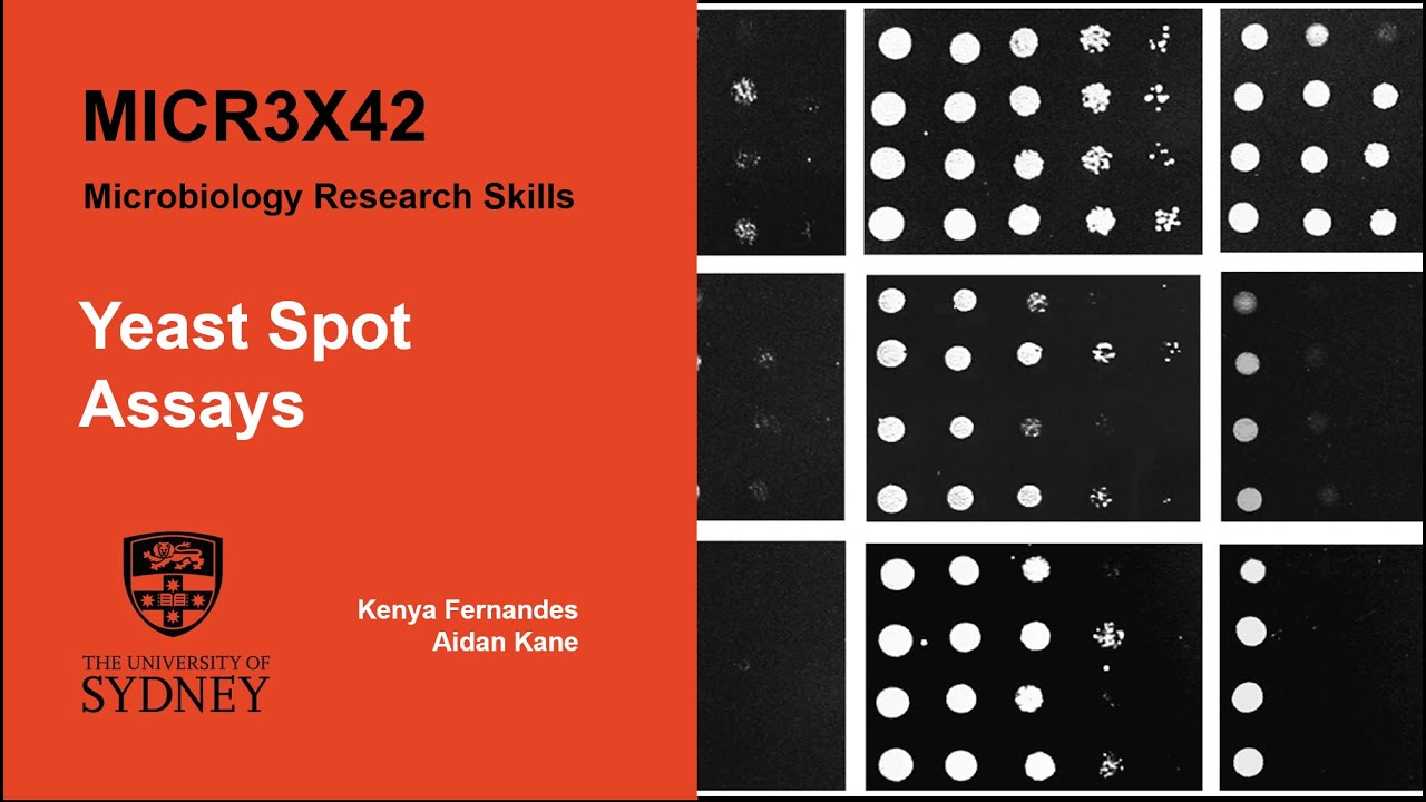 Experiment B - Yeast Spot Assays